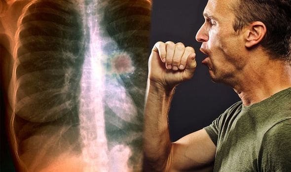 Homem tossindo ao lado de uma imagem de um pulmão preto de monóxido de carbono